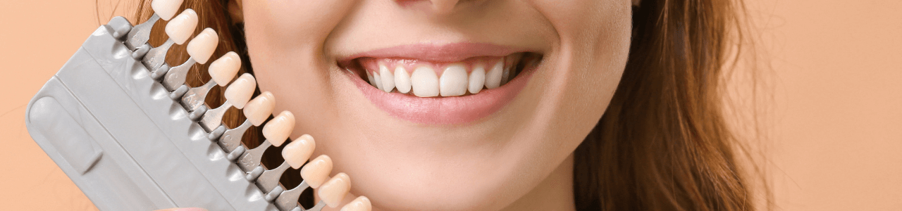 Veneers und Bleaching in Starnberg